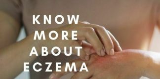 Know More About Eczema, Symptoms and Causes